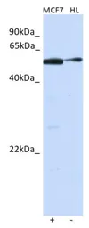 Anti-BARX2 antibody used in Western Blot (WB). GTX05270