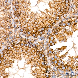 Anti-ROMO1 antibody [ARC71752] used in IHC (Paraffin sections) (IHC-P). GTX05275