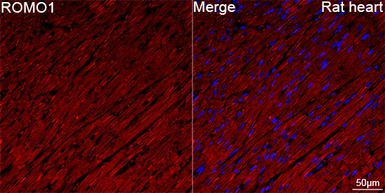 Anti-ROMO1 antibody [ARC71752] used in IHC (Paraffin sections) (IHC-P). GTX05275