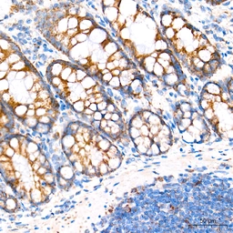 Anti-ROMO1 antibody [ARC71752] used in IHC (Paraffin sections) (IHC-P). GTX05275