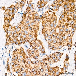 Anti-ROMO1 antibody [ARC71752] used in IHC (Paraffin sections) (IHC-P). GTX05275
