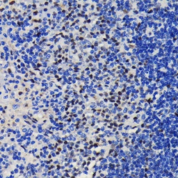 Anti-KAP1 antibody [GT1161] used in IHC (Paraffin sections) (IHC-P). GTX08968