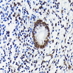 Anti-KAP1 antibody [GT1161] used in IHC (Paraffin sections) (IHC-P). GTX08968