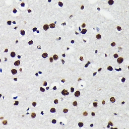 Anti-KAP1 antibody [GT1161] used in IHC (Paraffin sections) (IHC-P). GTX08968