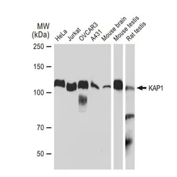 Anti-KAP1 antibody [GT1161] used in Western Blot (WB). GTX08968
