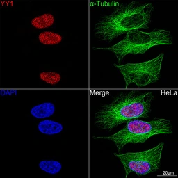 Anti-YY1 antibody [GT1162] used in Immunocytochemistry/ Immunofluorescence (ICC/IF). GTX08969
