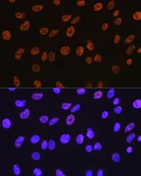 Anti-HDAC1 antibody [GT1163] used in IHC (Paraffin sections) (IHC-P). GTX08970