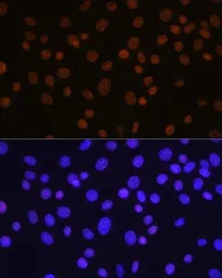 Anti-HDAC1 antibody [GT1163] used in IHC (Paraffin sections) (IHC-P). GTX08970