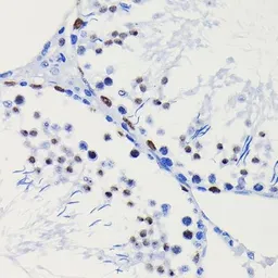 Anti-HDAC1 antibody [GT1163] used in Immunocytochemistry/ Immunofluorescence (ICC/IF). GTX08970