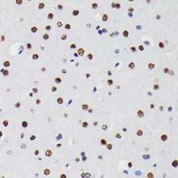 Anti-HDAC1 antibody [GT1163] used in Immunocytochemistry/ Immunofluorescence (ICC/IF). GTX08970
