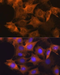 Anti-Hsp90 beta antibody [GT1164] used in Immunocytochemistry/ Immunofluorescence (ICC/IF). GTX09012