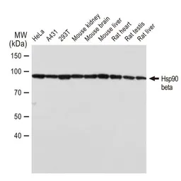 Anti-Hsp90 beta antibody [GT1164] used in Western Blot (WB). GTX09012