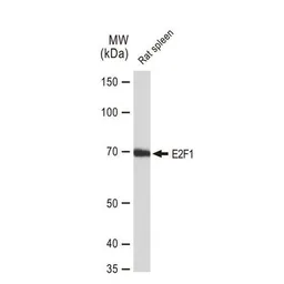 Anti-E2F1 antibody [GT1167] used in Western Blot (WB). GTX09015