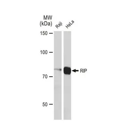 Anti-RIP antibody [GT1168] used in Western Blot (WB). GTX09128