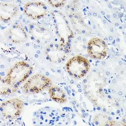 Anti-Fas antibody [GT1169] used in IHC (Paraffin sections) (IHC-P). GTX09129