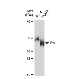 Anti-Fas antibody [GT1169] used in Western Blot (WB). GTX09129