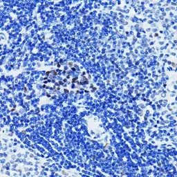 Anti-PARP antibody [GT1176] used in IHC (Paraffin sections) (IHC-P). GTX09509