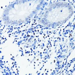Anti-PARP antibody [GT1176] used in IHC (Paraffin sections) (IHC-P). GTX09509
