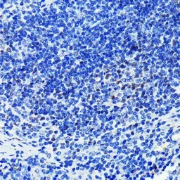 Anti-PARP antibody [GT1176] used in IHC (Paraffin sections) (IHC-P). GTX09509