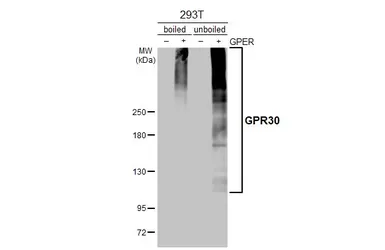 Anti-GPR30 antibody used in Western Blot (WB). GTX100001