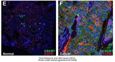 Anti-CXCR7 antibody [C1C2], Internal used in IHC (Paraffin sections) (IHC-P). GTX100027