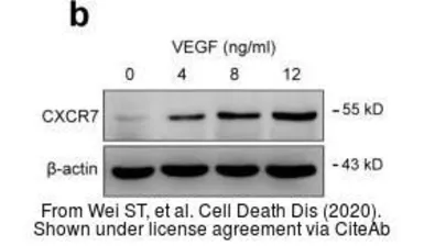 Anti-CXCR7 antibody [C1C2], Internal used in Western Blot (WB). GTX100027