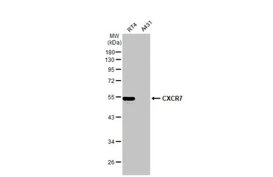 Anti-CXCR7 antibody [C1C2], Internal used in Western Blot (WB). GTX100027