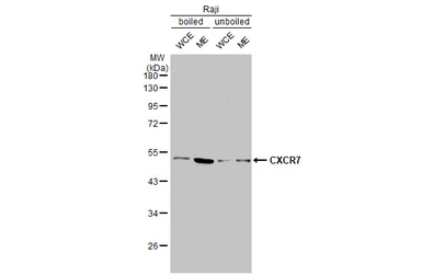 Anti-CXCR7 antibody [C1C2], Internal used in Western Blot (WB). GTX100027