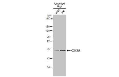 Anti-CXCR7 antibody [C1C2], Internal used in Western Blot (WB). GTX100027