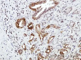Anti-CXCR7 antibody [C1C2], Internal used in IHC (Paraffin sections) (IHC-P). GTX100027