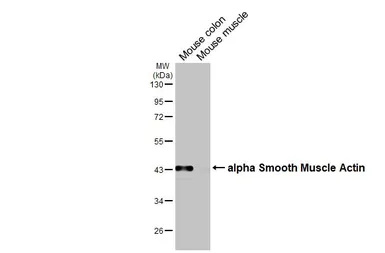 Anti-alpha Smooth Muscle Actin antibody used in Western Blot (WB). GTX100034