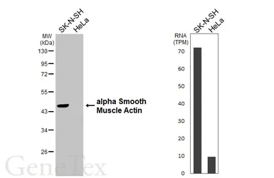 Anti-alpha Smooth Muscle Actin antibody used in Western Blot (WB). GTX100034