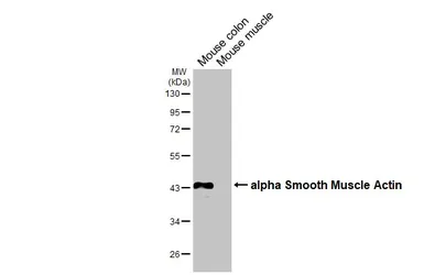 Anti-alpha Smooth Muscle Actin antibody used in Western Blot (WB). GTX100034