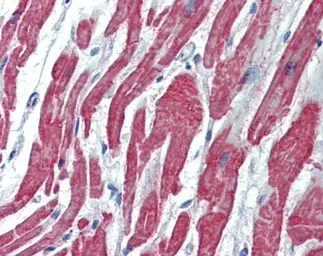Anti-ACVRL1 antibody [C3], C-term used in IHC (Paraffin sections) (IHC-P). GTX100035