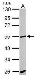 Anti-ACVRL1 antibody [C3], C-term used in Western Blot (WB). GTX100035