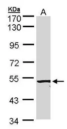 Anti-ACVRL1 antibody [C3], C-term used in Western Blot (WB). GTX100035