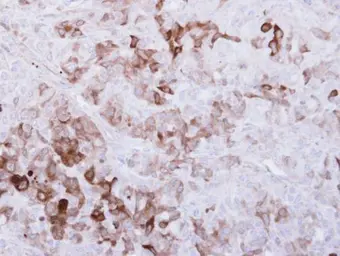 Anti-ALDH1A1 antibody [C3-2], C-term used in IHC (Paraffin sections) (IHC-P). GTX100044