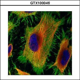 Anti-Annexin II antibody [N1], N-term used in Immunocytochemistry/ Immunofluorescence (ICC/IF). GTX100046