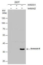 Anti-Annexin II antibody [N1], N-term used in Western Blot (WB). GTX100046