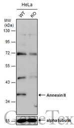 Anti-Annexin II antibody [N1], N-term used in Western Blot (WB). GTX100046
