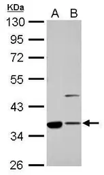 Anti-Annexin II antibody [N1], N-term used in Western Blot (WB). GTX100046