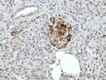 Anti-Annexin II antibody [N1], N-term used in IHC (Paraffin sections) (IHC-P). GTX100046