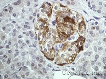 Anti-Annexin II antibody [N1], N-term used in IHC (Paraffin sections) (IHC-P). GTX100046