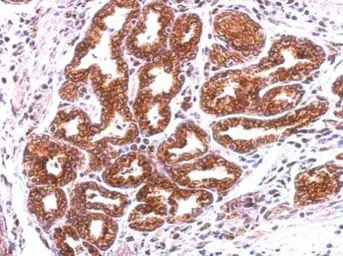Anti-Annexin A13 antibody [N1], N-term used in IHC (Paraffin sections) (IHC-P). GTX100048