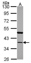 Anti-Annexin A13 antibody [N1], N-term used in Western Blot (WB). GTX100048