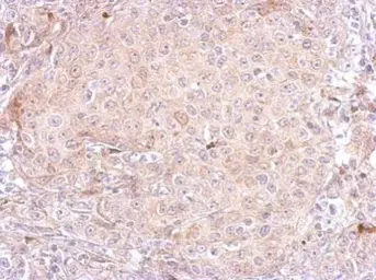 Anti-PSA antibody [C2C3], C-term used in IHC (Paraffin sections) (IHC-P). GTX100054