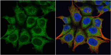 Anti-TRIM23 antibody [N1], N-term used in Immunocytochemistry/ Immunofluorescence (ICC/IF). GTX100057