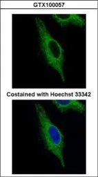 Anti-TRIM23 antibody [N1], N-term used in Immunocytochemistry/ Immunofluorescence (ICC/IF). GTX100057