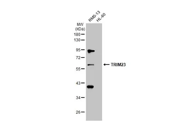 Anti-TRIM23 antibody [N1], N-term used in Western Blot (WB). GTX100057