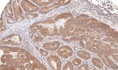 Anti-TRIM23 antibody [N1], N-term used in IHC (Paraffin sections) (IHC-P). GTX100057